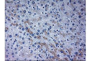 Immunohistochemical staining of paraffin-embedded liver tissue using anti-NEUROG3mouse monoclonal antibody.