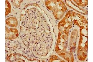 Immunohistochemistry of paraffin-embedded human kidney tissue using ABIN7175150 at dilution of 1:100 (USHBP1 anticorps  (AA 1-260))