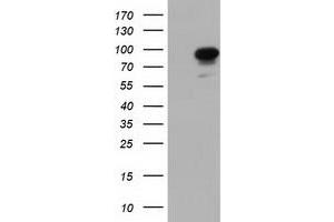 Western Blotting (WB) image for anti-phosphoinositide-3-Kinase Adaptor Protein 1 (PIK3AP1) antibody (ABIN1496821) (PIK3AP1 anticorps)