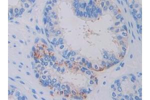 Used in DAB staining on fromalin fixed paraffin- embedded glioma tissue (Factor VII anticorps  (AA 334-452))