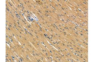 ABIN7094629 and ABIN7098679 at 1/100 staining Rat heart tissue by IHC-P.