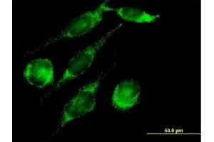 Immunofluorescence of purified MaxPab antibody to PECI on HeLa cell.