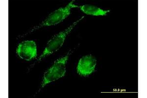 Immunofluorescence of purified MaxPab antibody to PECI on HeLa cell. (PECI/ECI2 anticorps  (AA 1-364))