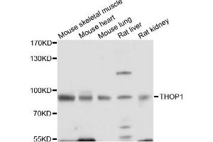 Western blot analysis of extracts of various cell lines, using THOP1 antibody. (Thimet Oligopeptidase 1 anticorps)