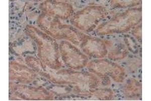 IHC-P analysis of Human Kidney Tissue, with DAB staining. (LGALS8 anticorps  (AA 1-317))