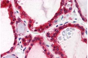 Human Thyroid (formalin-fixed, paraffin-embedded) stained with STIM1 antibody ABIN239828 at 5 ug/ml followed by biotinylated anti-mouse IgG secondary antibody ABIN481714, alkaline phosphatase-streptavidin and chromogen. (STIM1 anticorps  (C-Term))