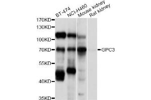 Western blot analysis of extracts of various cell lines, using GPC3 antibody (ABIN5997818) at 1/1000 dilution. (Glypican 3 anticorps)