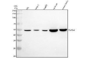 anti-Pleiomorphic Adenoma Gene-Like 2 (PLAGL2) (AA 269-365) antibody