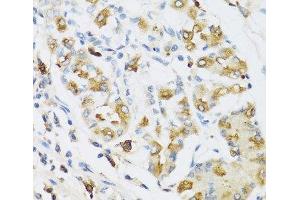 Immunohistochemistry of paraffin-embedded Human stomach using RNASE3 Polyclonal Antibody at dilution of 1:100 (40x lens). (RNASE3 anticorps)