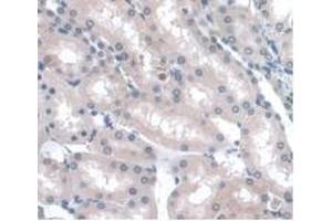 Detection of LRG1 in Rat Kidney Tissue using Monoclonal Antibody to Leucine Rich Alpha-2-Glycoprotein 1 (LRG1) (LRG1 anticorps  (AA 154-332))