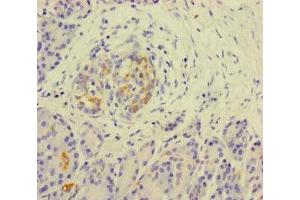 Immunohistochemistry of paraffin-embedded human pancreatic tissue using ABIN7157290 at dilution of 1:100 (KLHL3 anticorps  (AA 1-301))