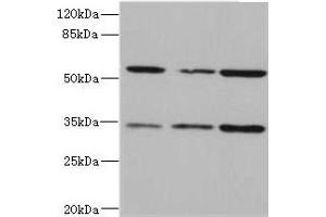 Western blot All lanes: IL17RB antibody at 2. (IL17 Receptor B anticorps  (AA 18-292))