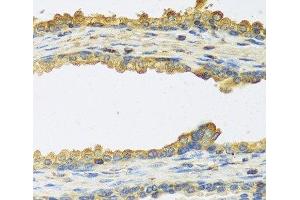 Immunohistochemistry of paraffin-embedded Human prostate using TSHB Polyclonal Antibody at dilution of 1:100 (40x lens). (TSHB anticorps)