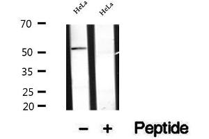 Western blot analysis of extracts of HeLa cells, using Secretogranin III antibody.