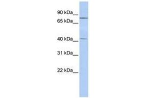 Image no. 1 for anti-Kelch-Like 3 (KLHL3) (C-Term) antibody (ABIN6740587) (KLHL3 anticorps  (C-Term))