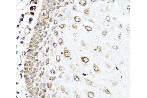 Immunohistochemistry of paraffin-embedded Human esophagus using RAC2 Polyclonal Antibody at dilution of 1:100 (40x lens).
