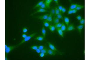 Image no. 9 for anti-Cardiac Troponin I (TNNI3) antibody (ABIN1497101)