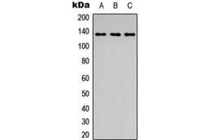 Western blot analysis of ABL1 (pY204) expression in HeLa colchicine-treated (A), mouse kidney (B), PC12 colchicine-treated (C) whole cell lysates.