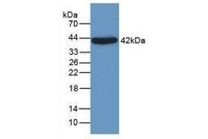 Detection of a1AGP in Rat Liver Tissue using Monoclonal Antibody to Alpha-1-Acid Glycoprotein (a1AGP)