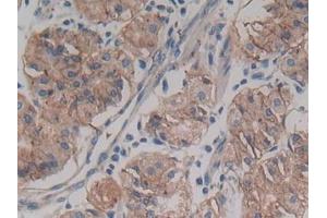 DAB staining on IHC-P; Samples: Human Stomach Tissue