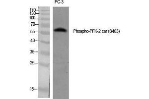 Western Blot (WB) analysis of specific cells using Phospho-PFK-2 car (S483) Polyclonal Antibody. (PFKFB2 anticorps  (pSer483))