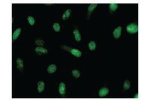 Immunostaining analysis in HeLa cells. (CRNKL1 anticorps)
