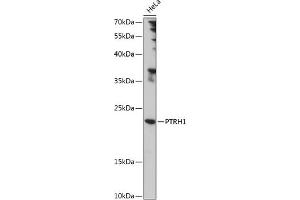Western blot analysis of extracts of HeLa cells, using PTRH1 antibody (ABIN7269210) at 1:1000 dilution. (PTRH1 anticorps  (AA 1-214))