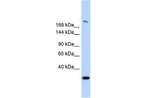 WB Suggested Anti-UTY Antibody Titration: 0. (UTY anticorps  (Middle Region))