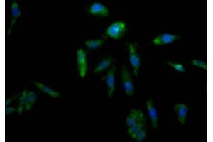 Immunofluorescence staining of Hela Cells with ABIN7127330 at 1:50, counter-stained with DAPI. (Recombinant AKR1C3 anticorps)