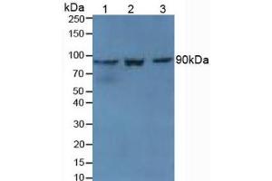 Western blot analysis of (1) Mouse Kidney Tissue, (2) Mouse Spleen Tissue and (3) Mouse Placenta Tissue. (TGM1 anticorps  (AA 337-607))