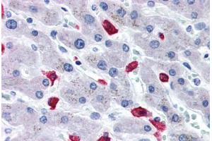 Human Liver (formalin-fixed, paraffin-embedded) stained with CD163 antibody ABIN337380 at 20 ug/ml followed by biotinylated goat anti-rabbit IgG secondary antibody ABIN481713, alkaline phosphatase-streptavidin and chromogen. (CD163 anticorps  (N-Term))