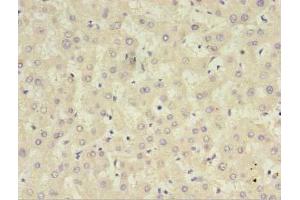 Immunohistochemistry of paraffin-embedded human liver tissue using ABIN7148394 at dilution of 1:100