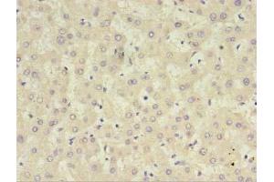 Immunohistochemistry of paraffin-embedded human liver tissue using ABIN7148394 at dilution of 1:100 (CFHR2 anticorps  (AA 20-269))