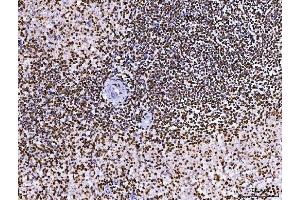 IHC analysis of RCC1 using anti-RCC1 antibody (ABIN7600022). (RCC1 anticorps  (AA 14-421))
