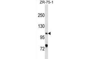 Western Blotting (WB) image for anti-Xeroderma Pigmentosum, Complementation Group C (XPC) antibody (ABIN3001097) (XPC anticorps)
