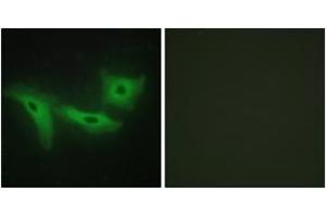 Immunofluorescence analysis of HeLa cells, using LRRK1 Antibody. (LRRK1 anticorps  (AA 361-410))