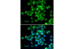 Immunofluorescence analysis of MCF7 cell using SIRT3 antibody. (SIRT3 anticorps)