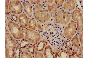 Immunohistochemistry of paraffin-embedded human kidney tissue using ABIN7143430 at dilution of 1:100 (Adrenomedullin anticorps  (AA 45-92))