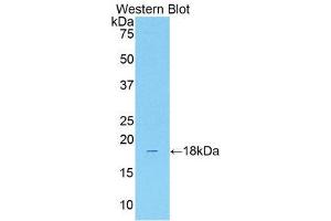 Western Blotting (WB) image for anti-Solute Carrier Family 12 (Sodium/Chloride Transporters), Member 3 (SLC12A3) (AA 3-146) antibody (ABIN1176282) (SLC12A3 anticorps  (AA 3-146))