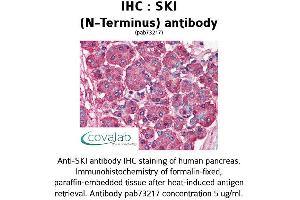 Image no. 1 for anti-SKI Proto-Oncogene (SKI) antibody (ABIN1739312) (SKI anticorps)