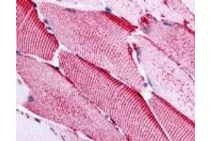 Immunohistochemistry (IHC) image for anti-Solute Carrier Family 5 (Sodium/glucose Cotransporter), Member 10 (SLC5A10) (Cytoplasmic Domain) antibody (ABIN2469314)