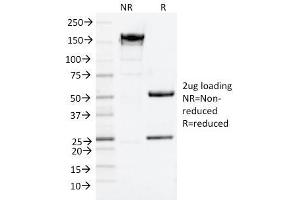SDS-PAGE Analysis Purified NGFR Mouse Monoclonal Antibody (NGFR/1964).