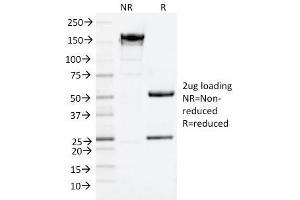 SDS-PAGE Analysis Purified NGFR Mouse Monoclonal Antibody (NGFR/1964). (NGFR anticorps  (AA 281-421))