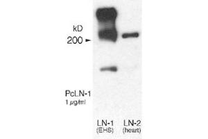 Western blot analysis of Lama1 using Lama1 polyclonal antibody . (Laminin alpha 1 anticorps)