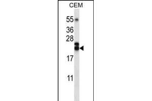 TNFSF4 Antibody (Center) (ABIN656220 and ABIN2845537) western blot analysis in CEM cell line lysates (35 μg/lane). (TNFSF4 anticorps  (AA 102-131))