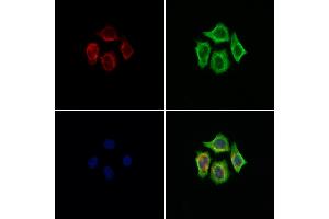 ABIN7094453 and ABIN7098501 staining Hela cells by IF/ICC. (LOX anticorps  (Internal Region))