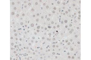 Immunohistochemistry of paraffin-embedded Rat liver using ZNF148 Polyclonal Antibody at dilution of 1:100 (40x lens). (ZNF148 anticorps)