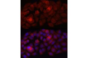 Immunofluorescence analysis of HeLa cells using Folate Binding Protein(FBP) / FOLR1 Rabbit mAb (ABIN7267223) at dilution of 1:100 (40x lens).