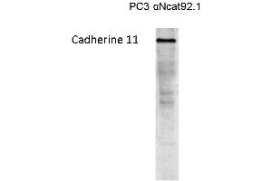 Western blot on a lysate of Cadherin 11 transfected PC3 cells