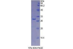 SDS-PAGE analysis of Mouse Galactosidase beta Protein. (GLB1 Protéine)